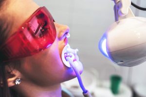 تقنية الليزر لعلاج الأسنان