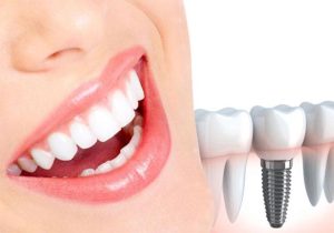 The best doctor for orthodontic treatment in Egypt