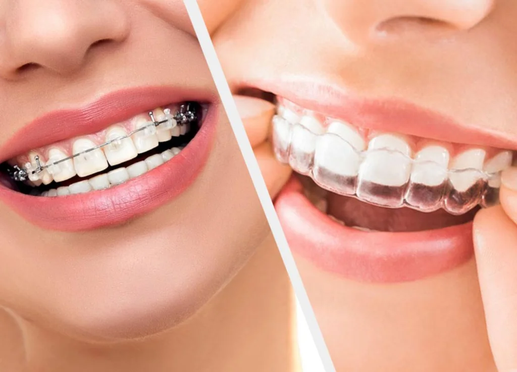 Orthodontics